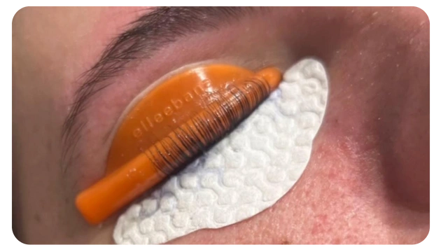 Close-up of an eye with an orange eyelash extension tool placed on the eyelid, surrounded by a padded eye patch for protection.